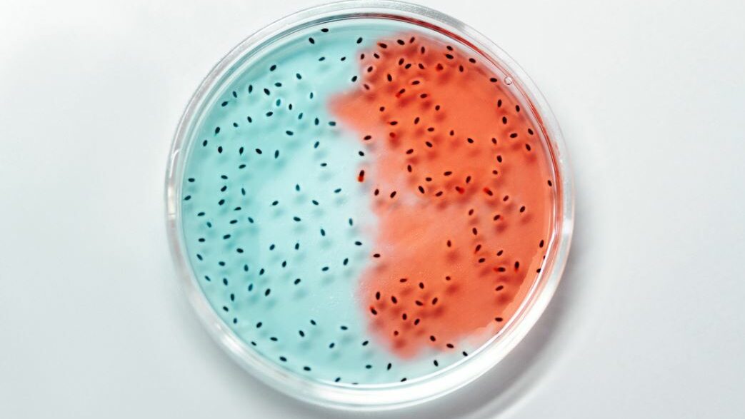 Petri dish